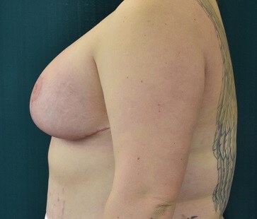 Side View After