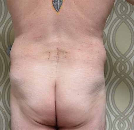 Back View Before