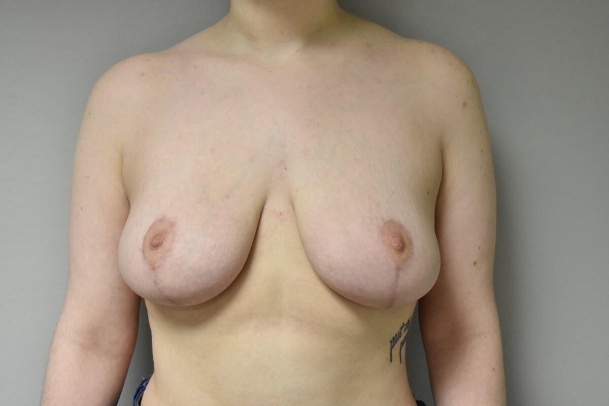 After Image