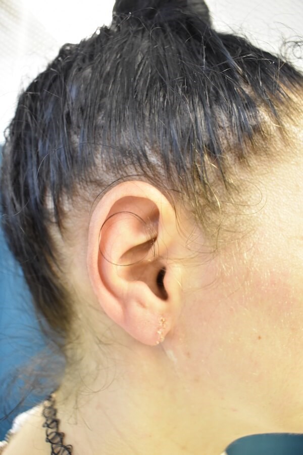 After Image