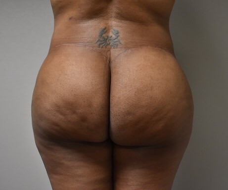 Back View After