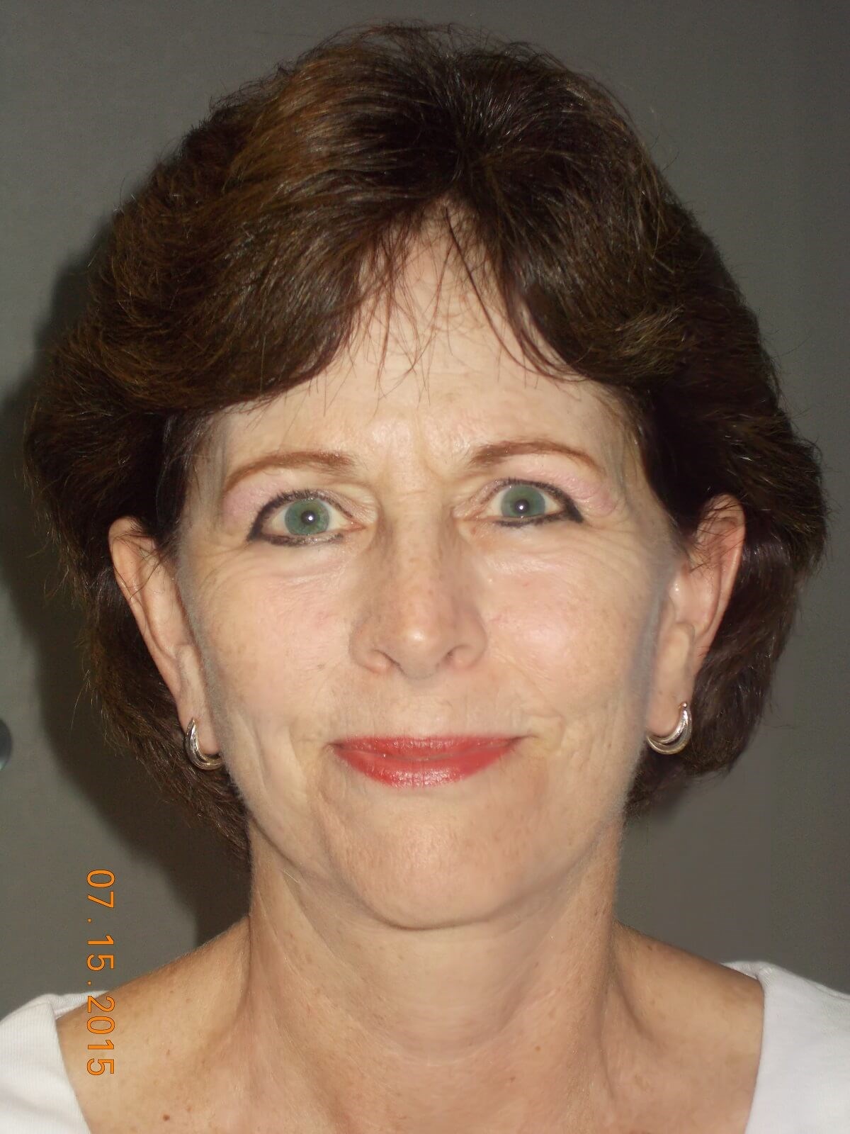 After Image