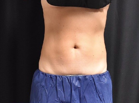 After Image