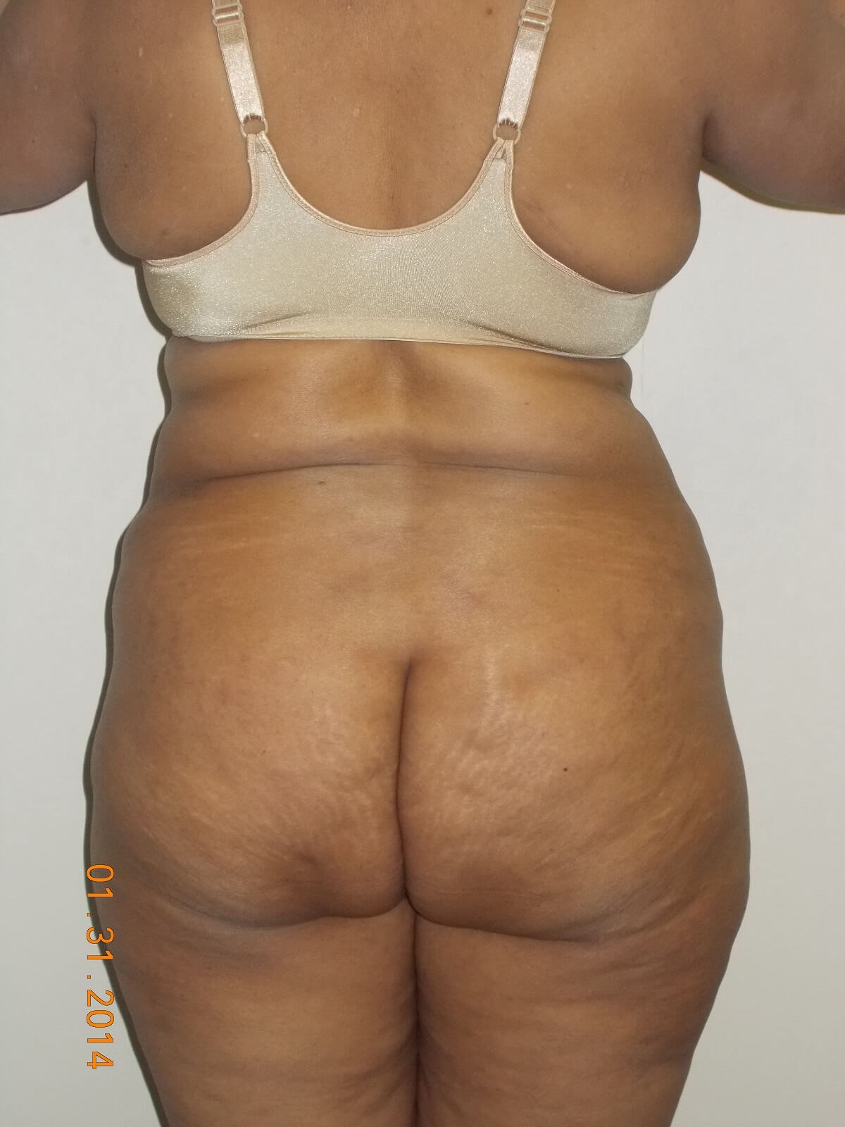 Back View Before