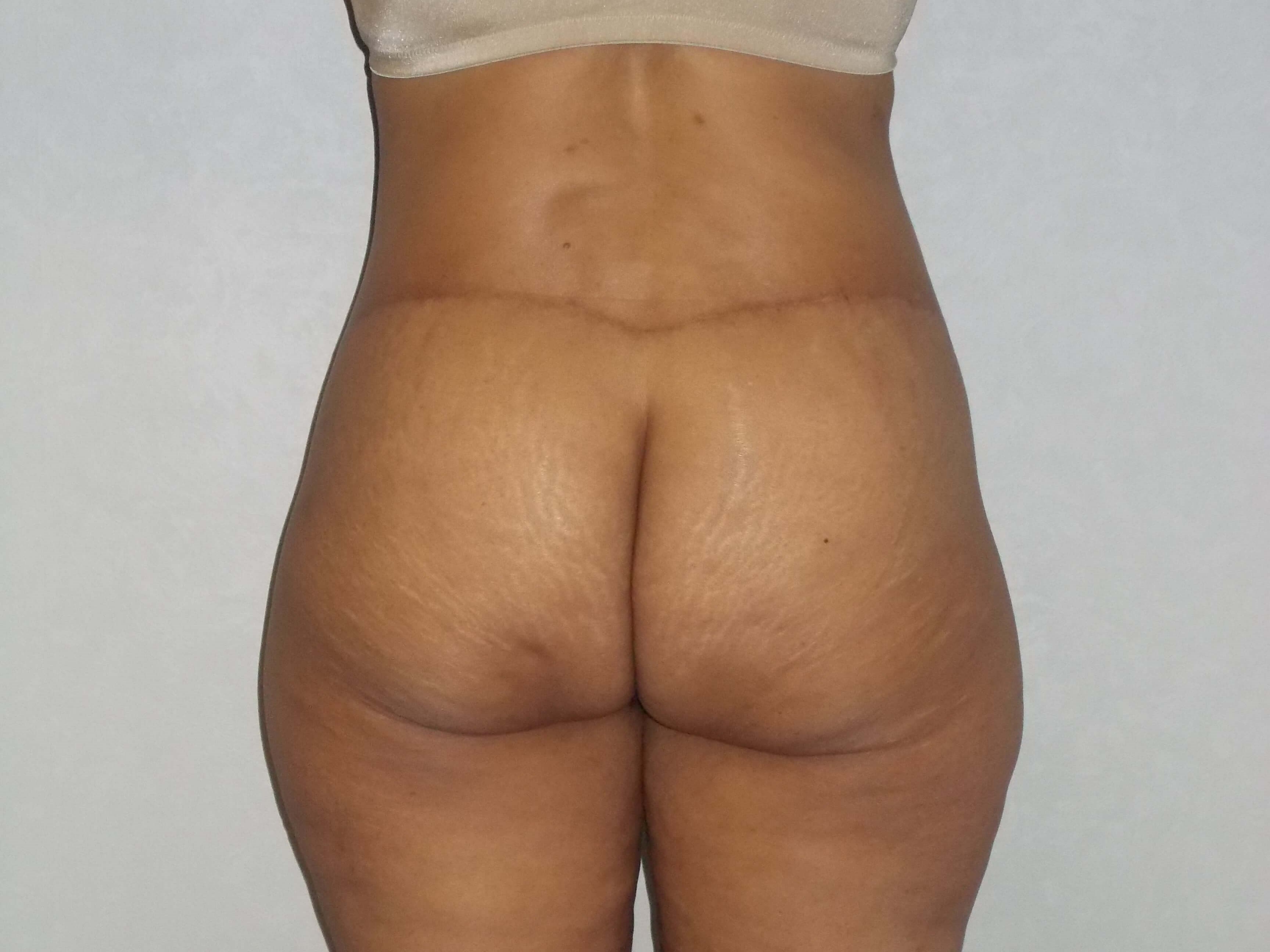 Back View After