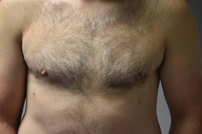 After Image