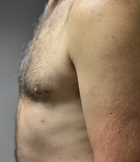 Side View After