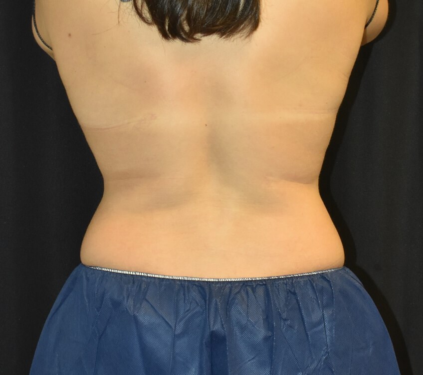 After Image