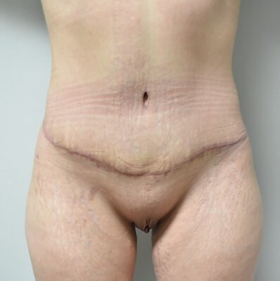 After Image
