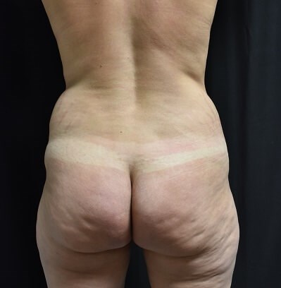 Back View Before