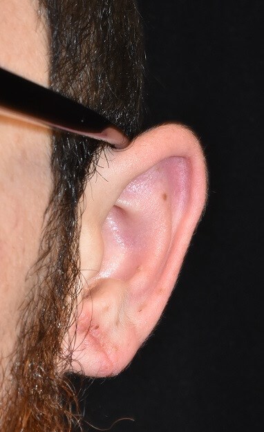 Side View After