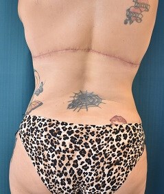 Back View After
