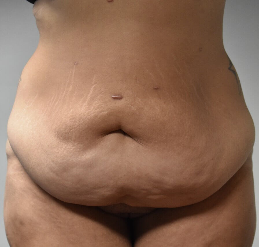 Before Image