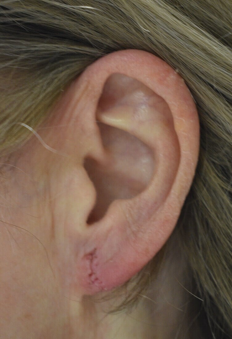 After Image