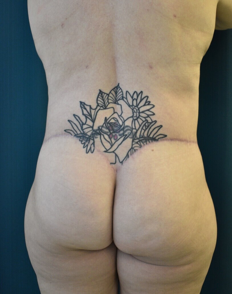 Back View After