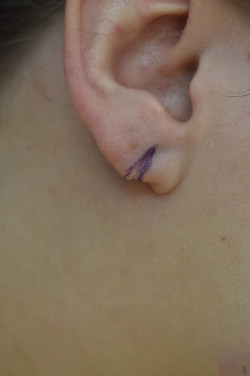 Fron View Before