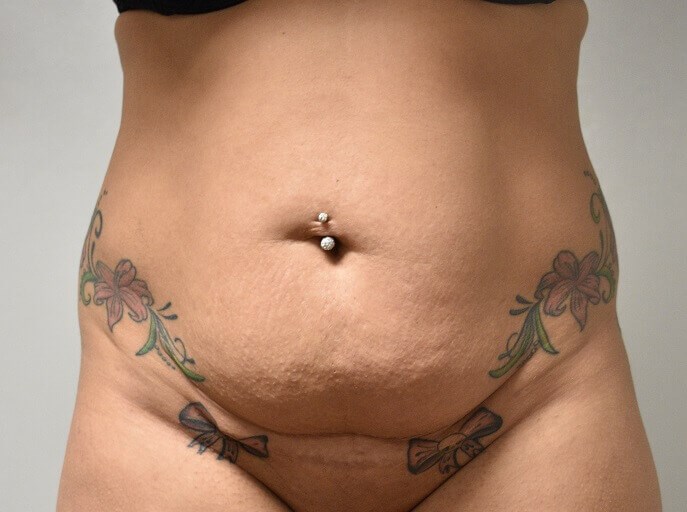Before Image