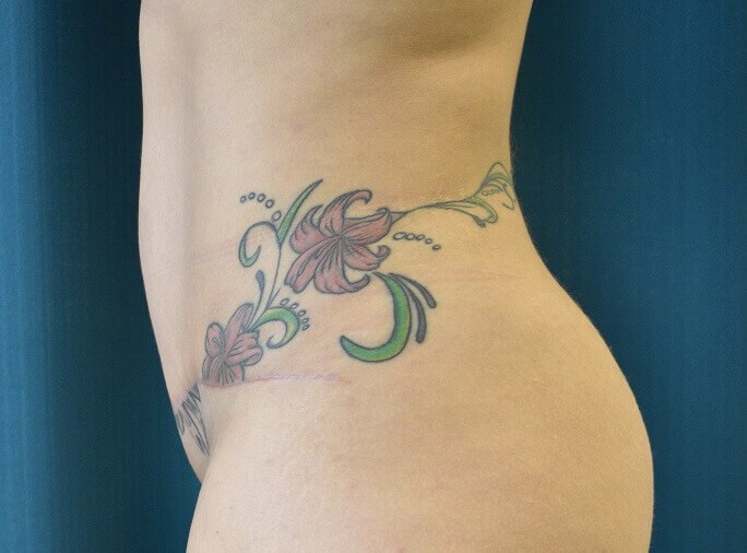 Side View After