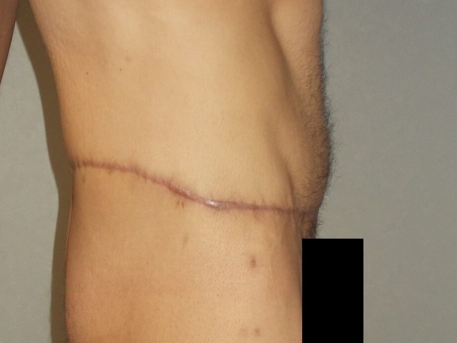 Side View After