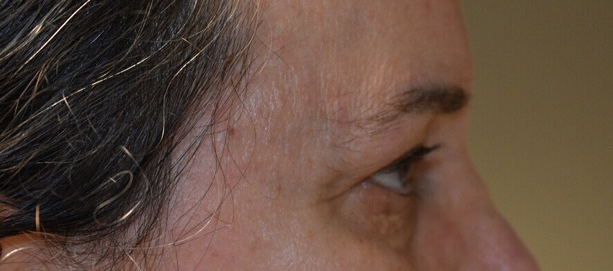 Side View Before