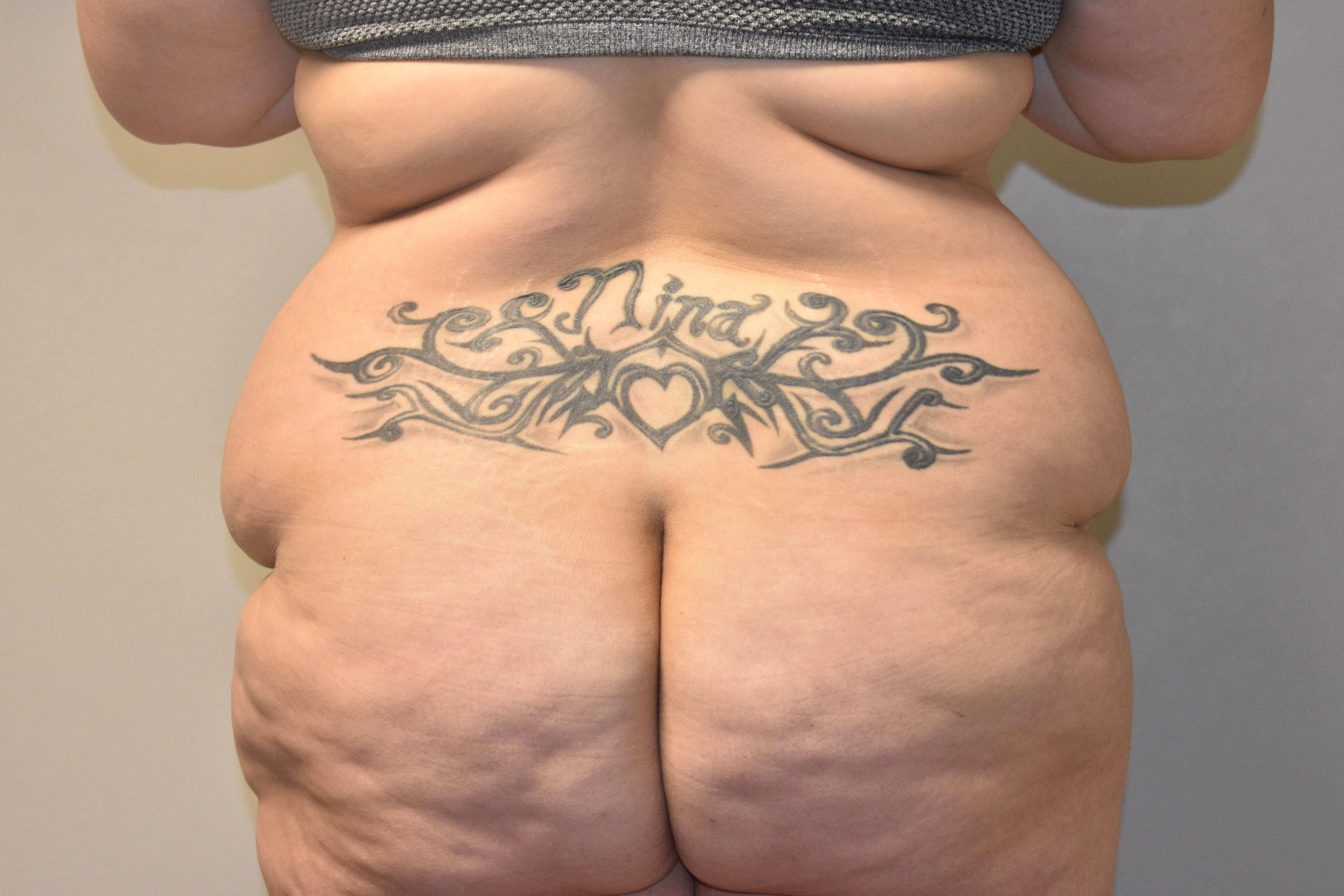 Back View Before