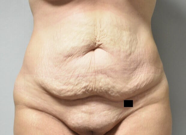 Before Image