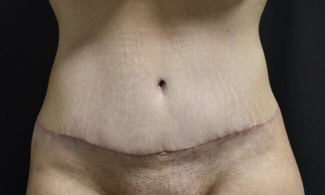 After Image