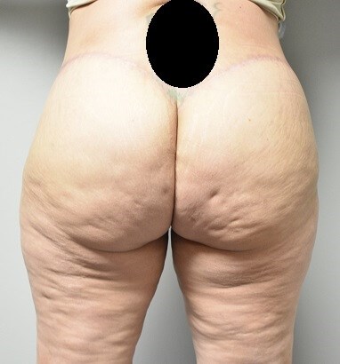 Back View After