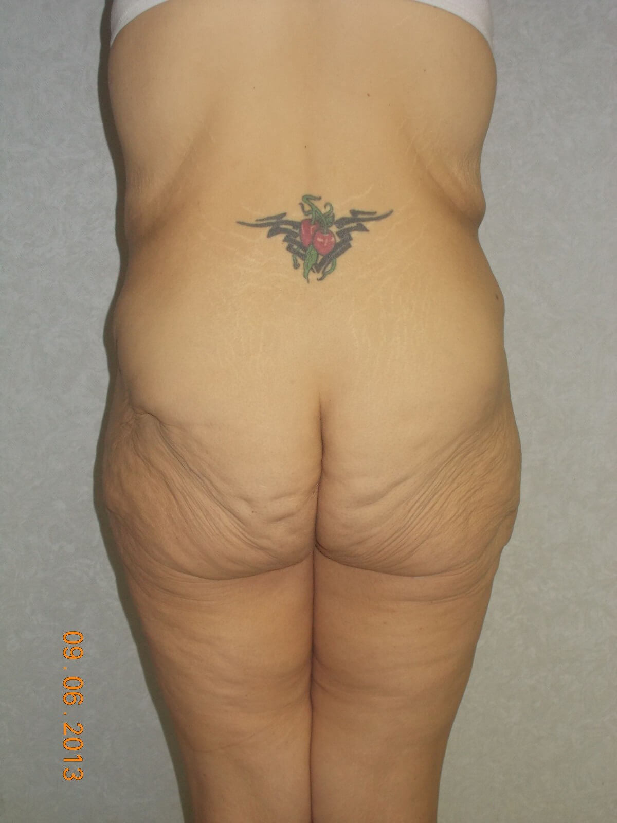 Back View Before