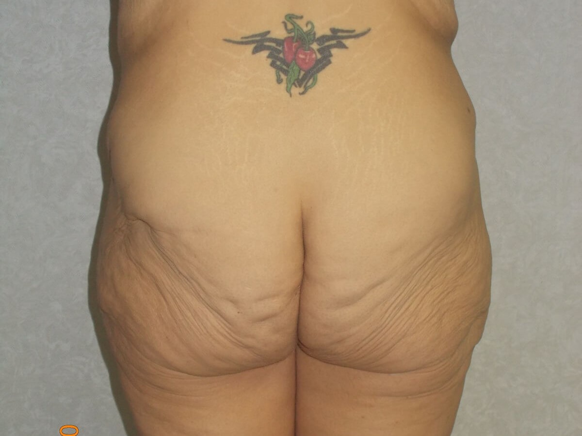 Back View Before