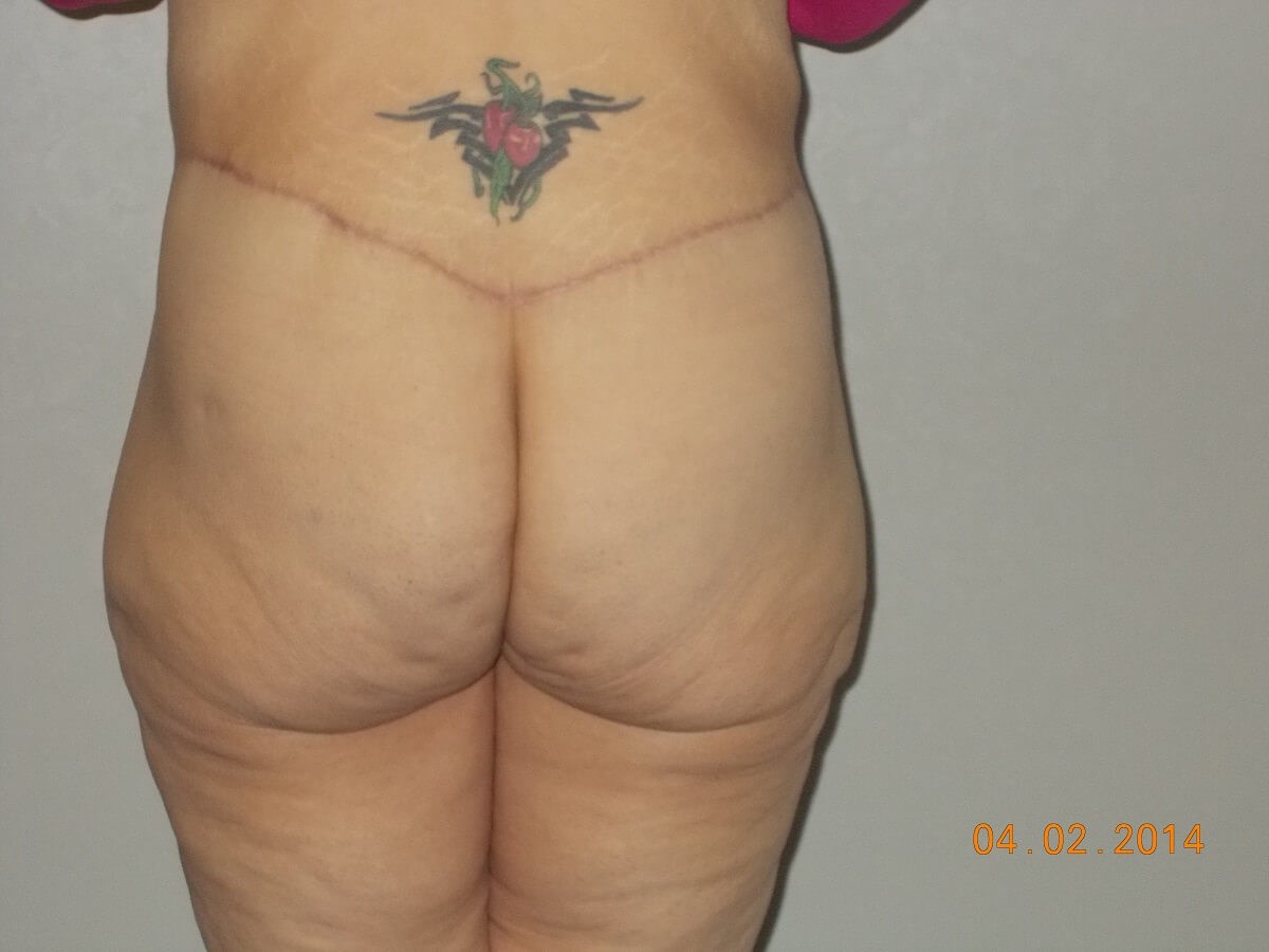 Back View After