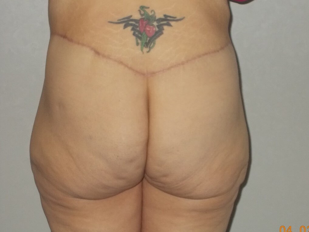 Back View After