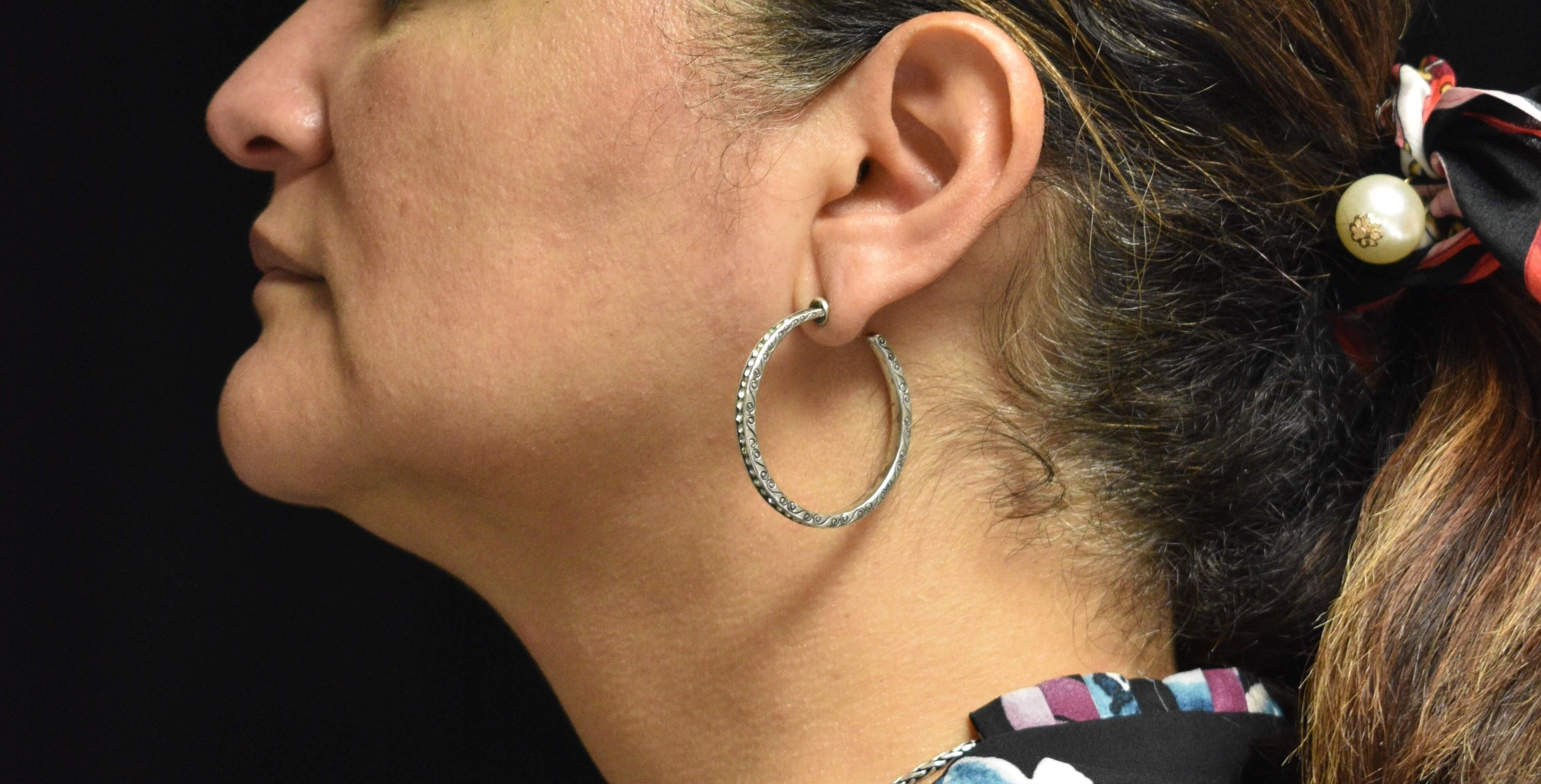 Side View After