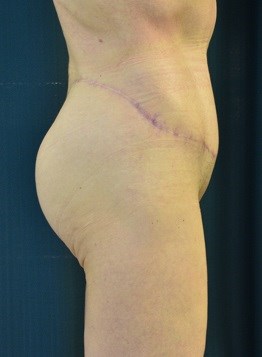 Right View After