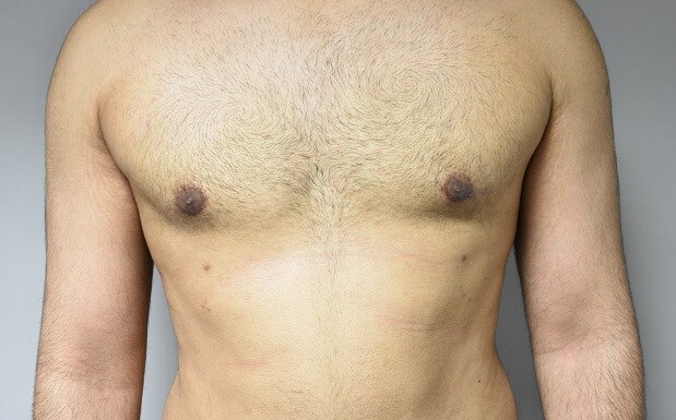 After Image
