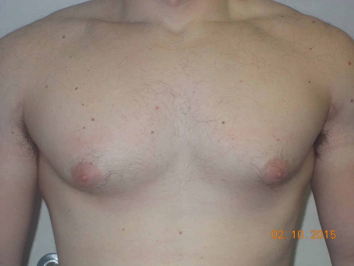 Before Image