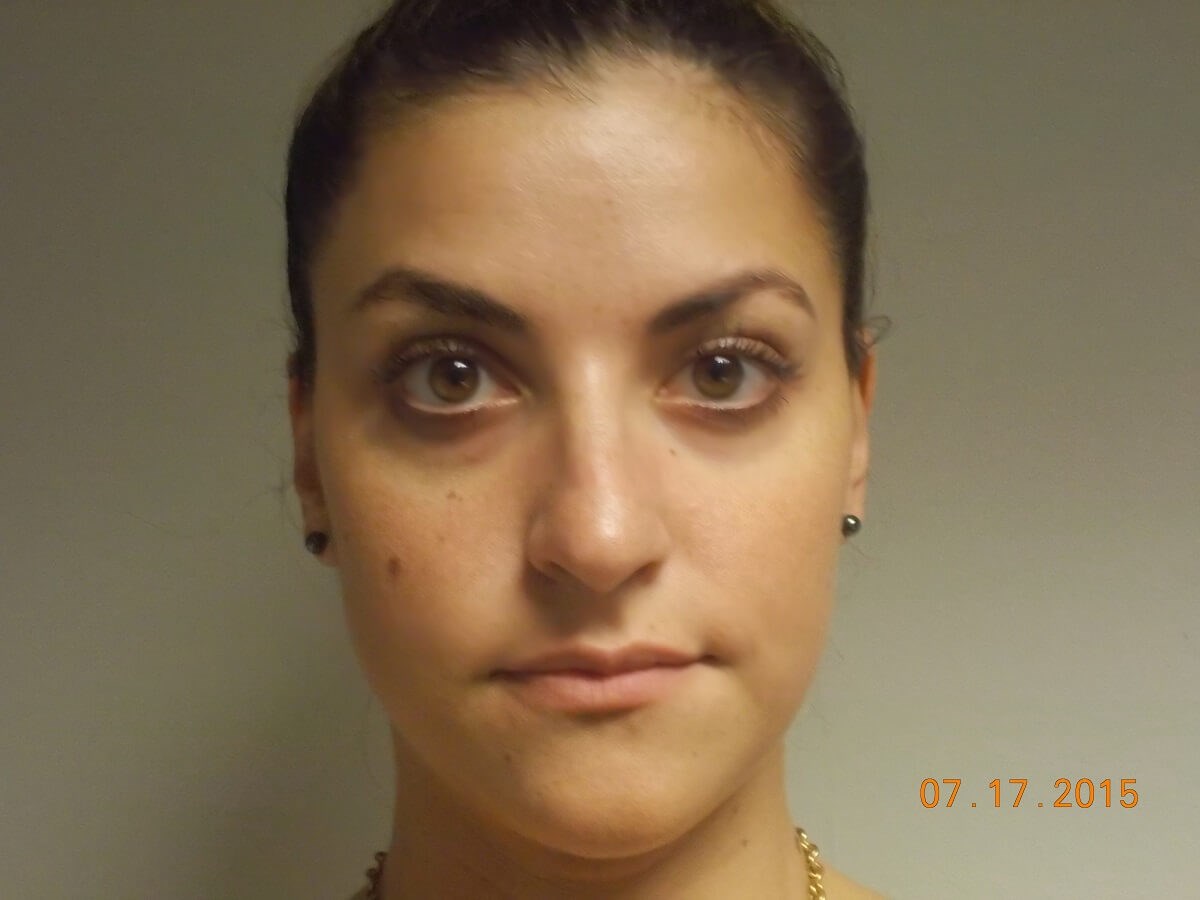 Before Image