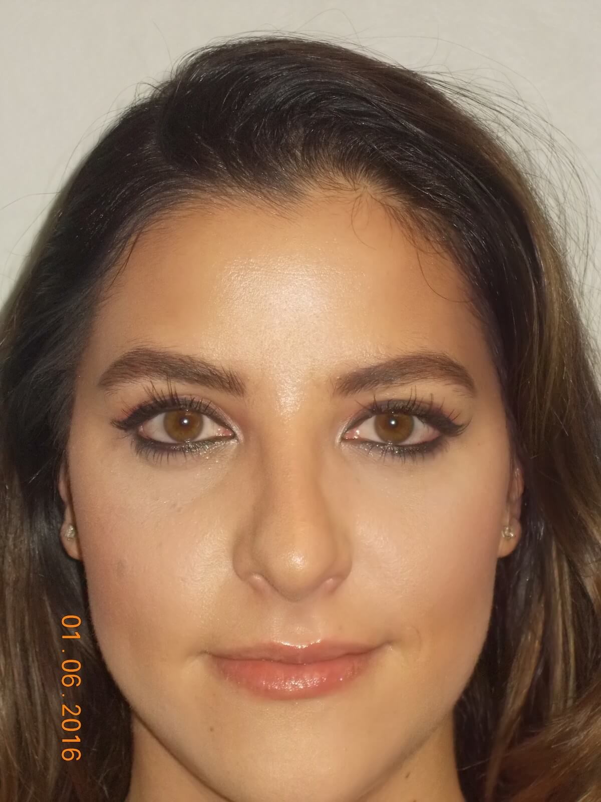 After Image