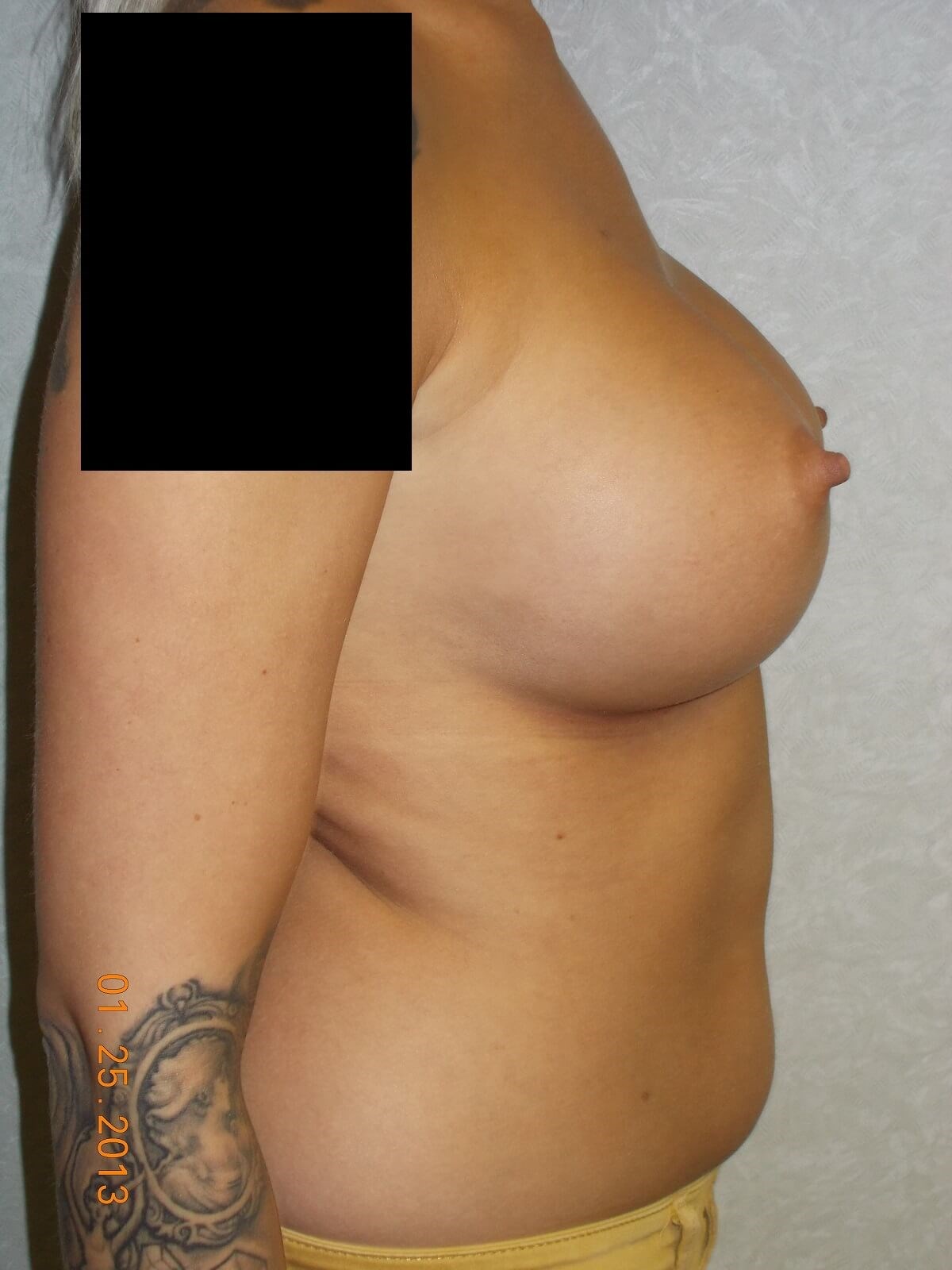Side View After