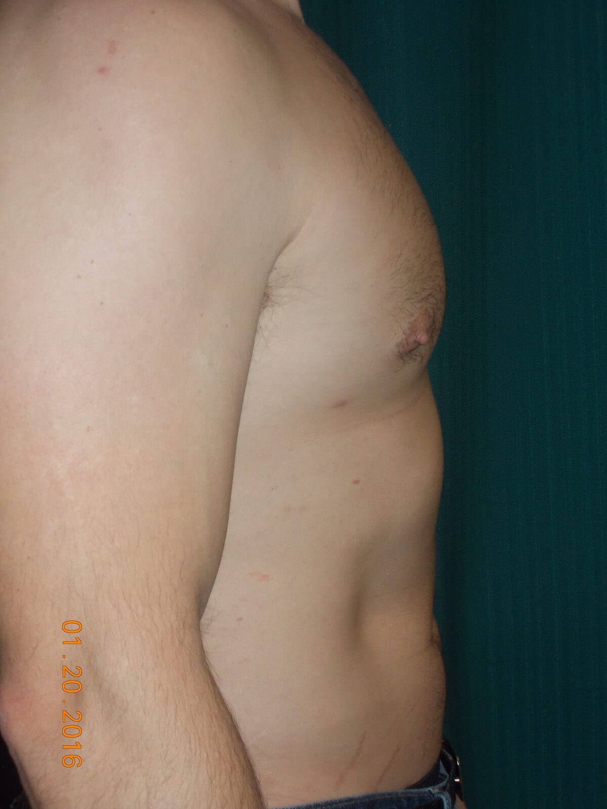 Side View After