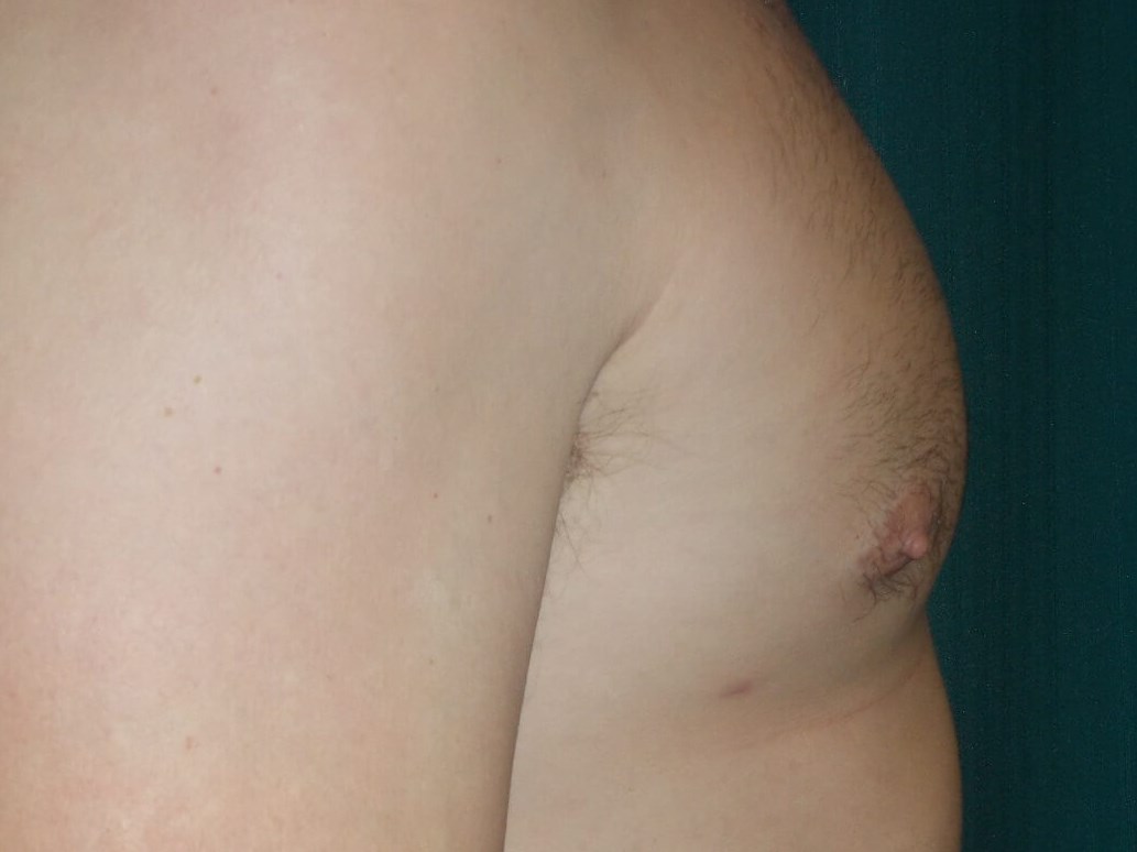Side View After