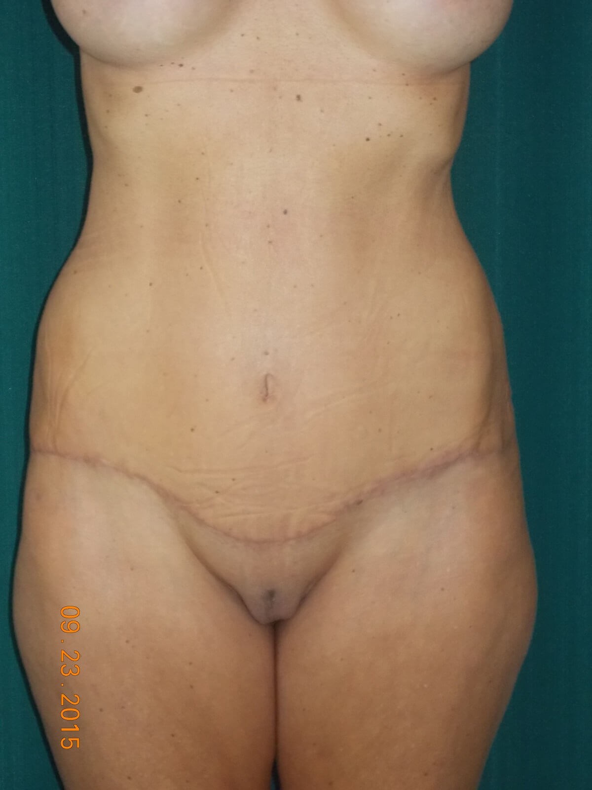 After Image