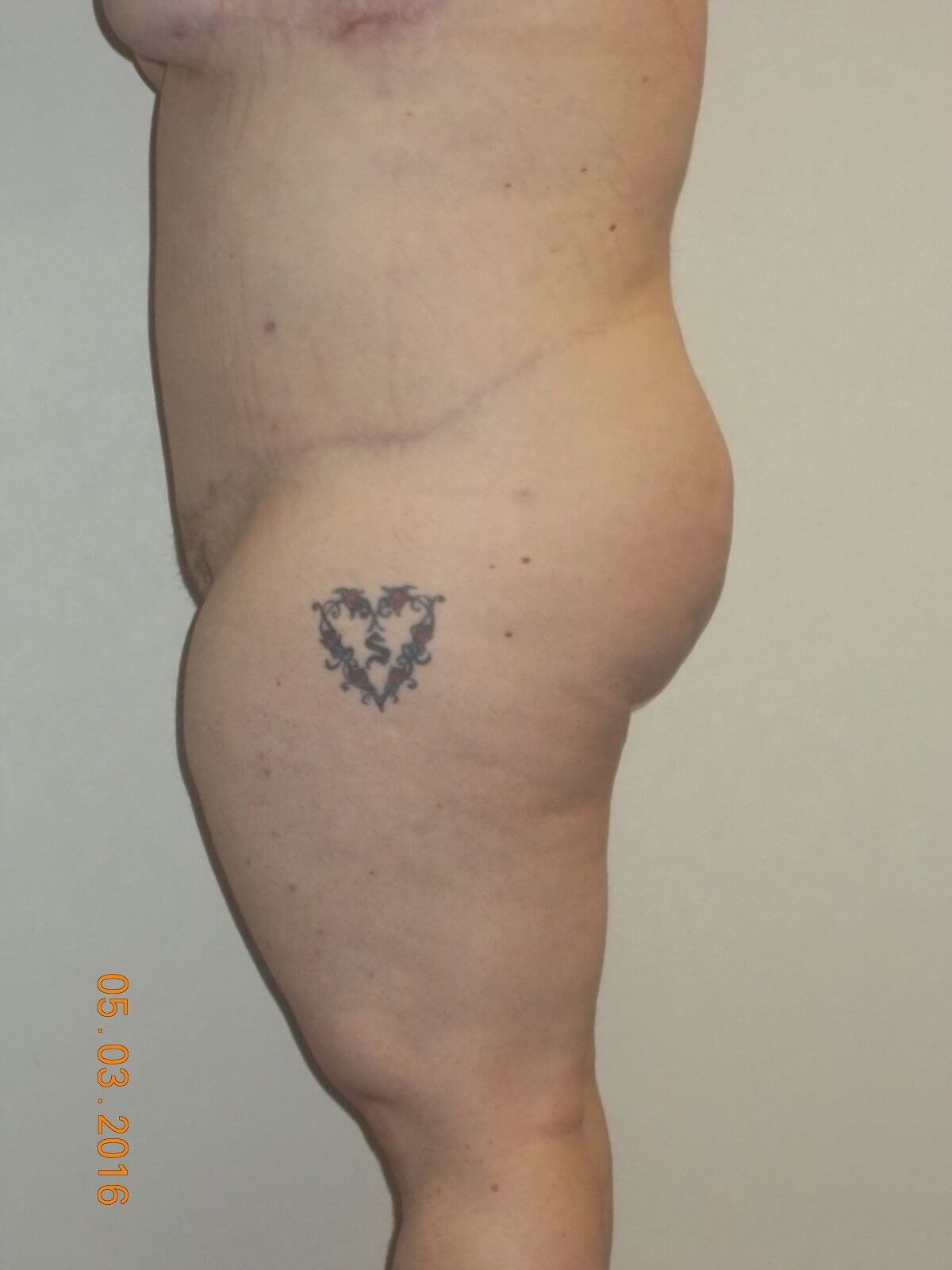 After Image