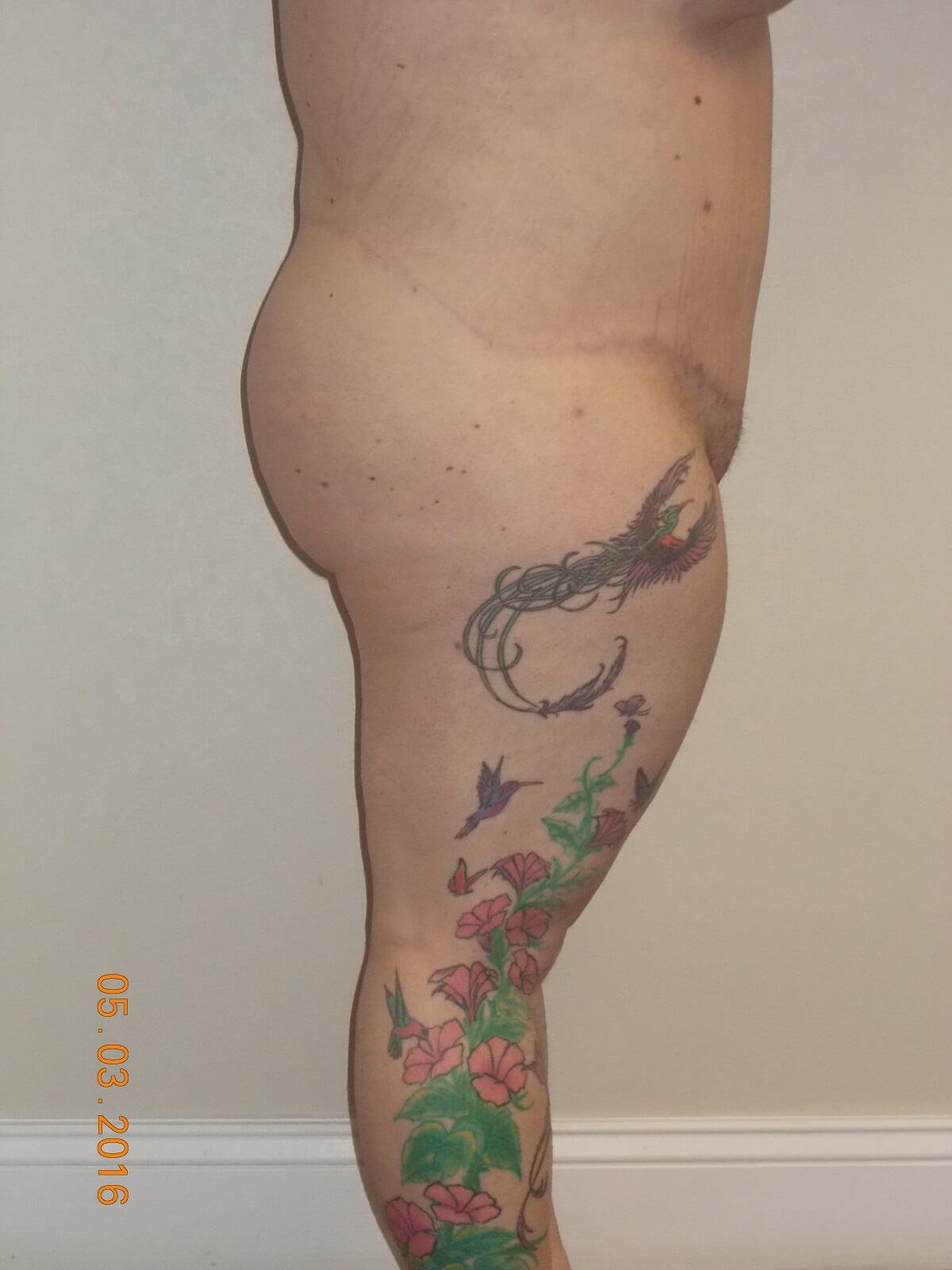 Side View After