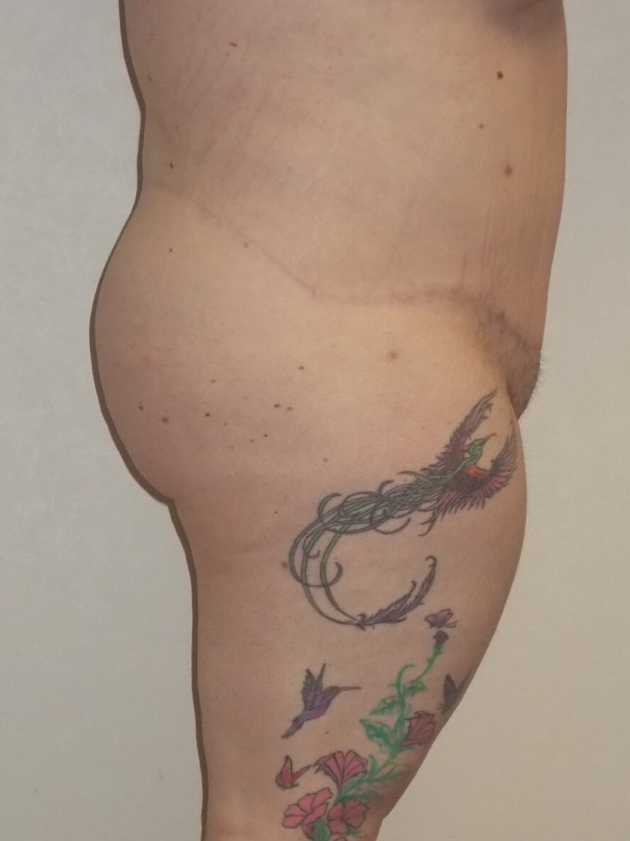 Side View After