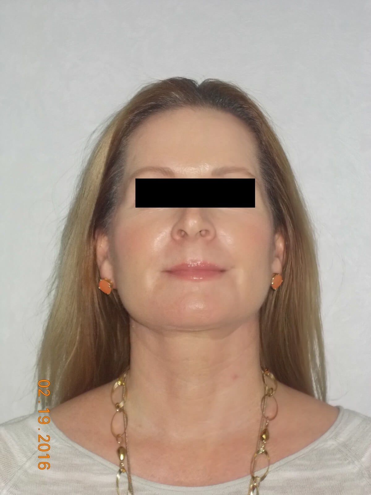 After Image