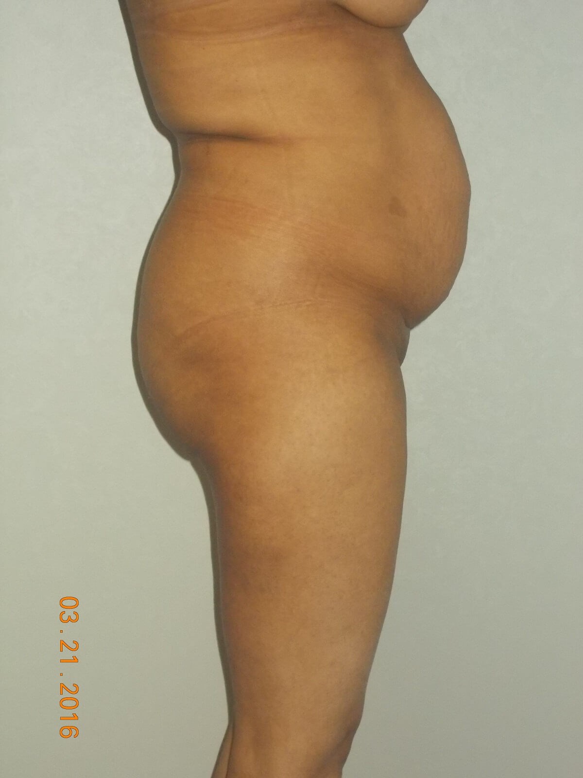 Before Image