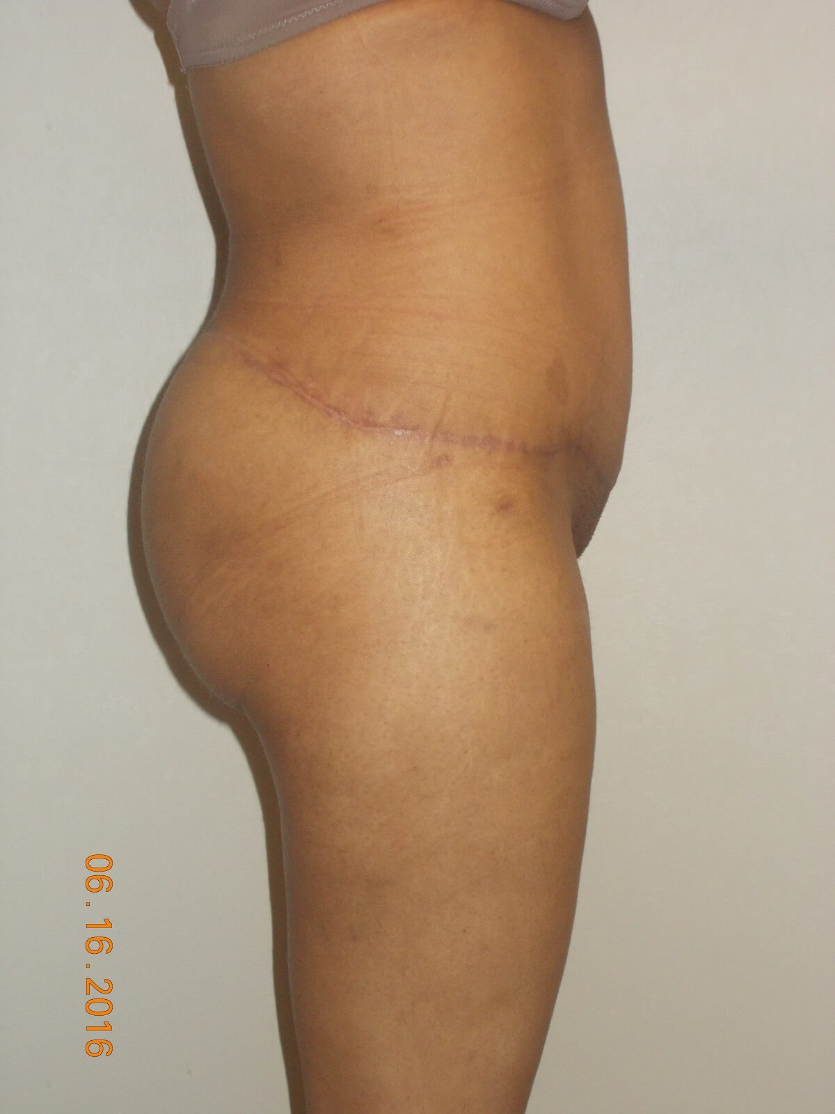 After Image