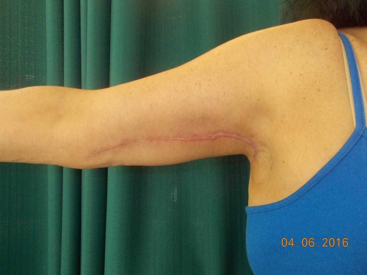 After Image
