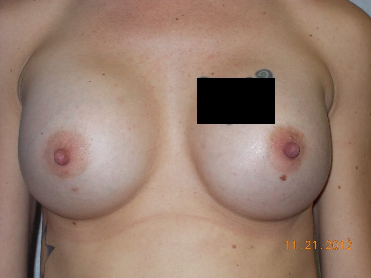 After Image